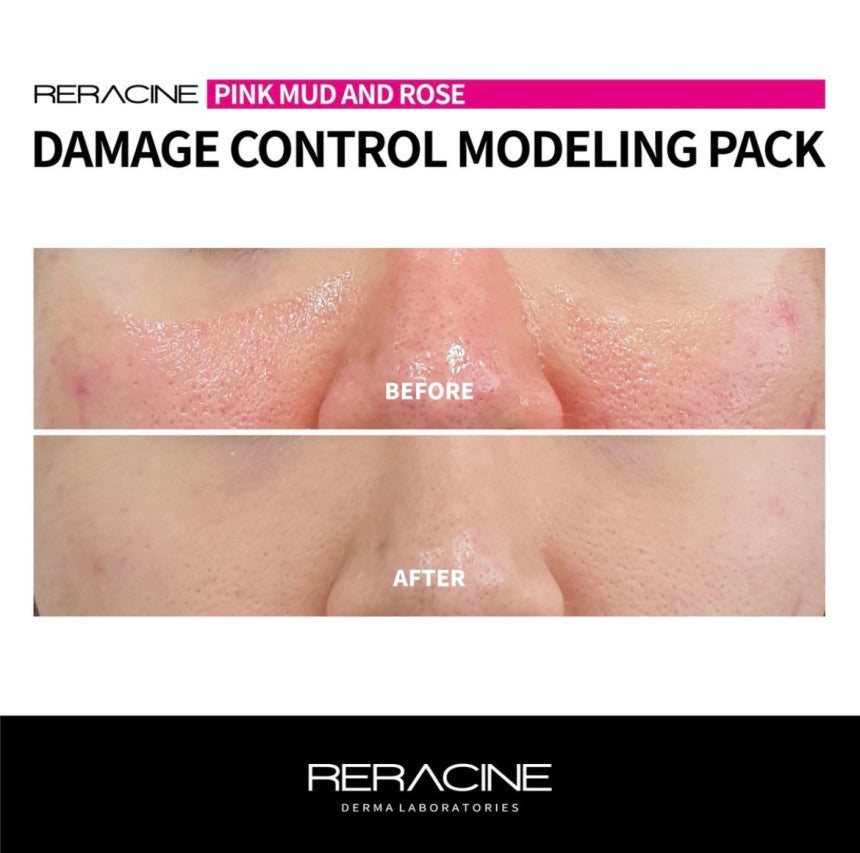 RERACINE DAMAGE CONTROL MODELING PACK / 50g x 10ea, 5g x 10ea