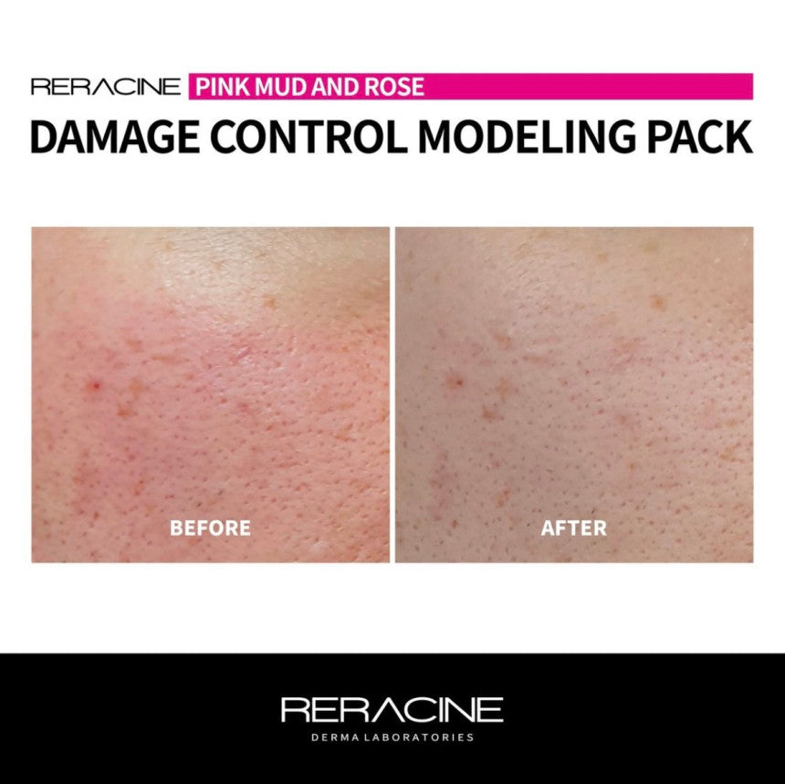 RERACINE DAMAGE CONTROL MODELING PACK / 50g x 10ea, 5g x 10ea